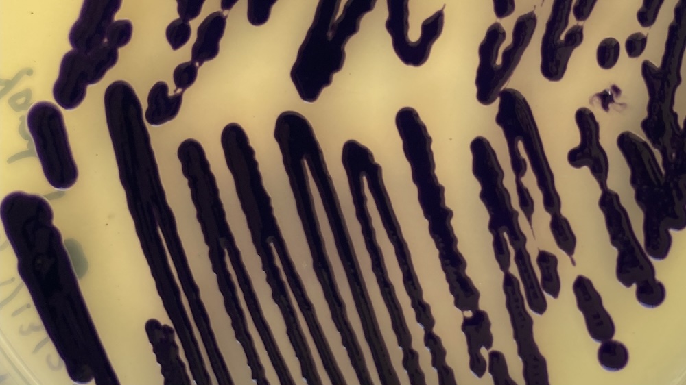 Purple Janthinobacterium colonies on an agar plate from Aster Bio product research and development