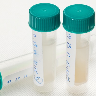 Labeled sample collection tubes ready for molecular testing