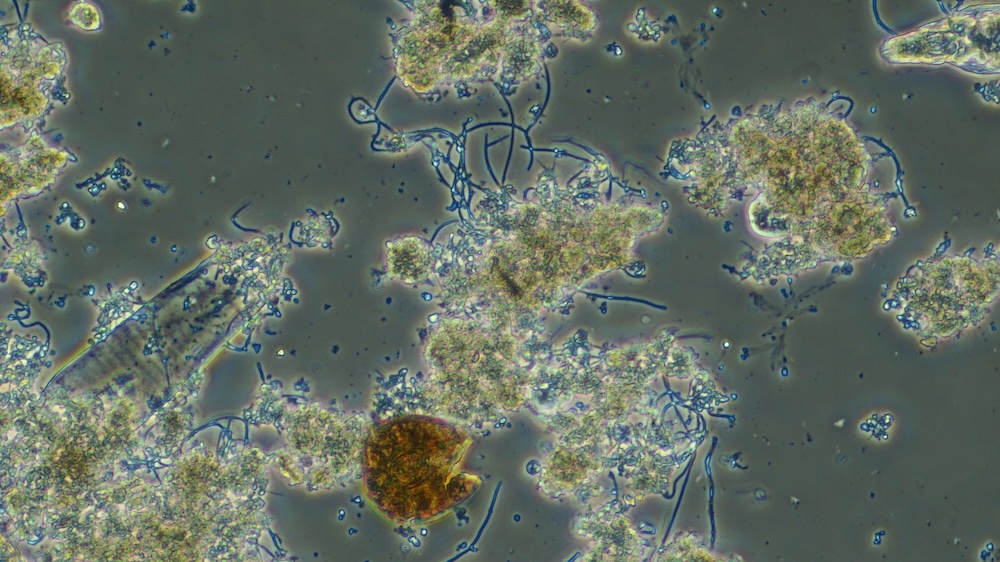 Phase-contrast micrograph of activated sludge floc with visible filaments