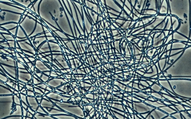 Micrograph showing filamentous organisms overrunning activated sludge floc